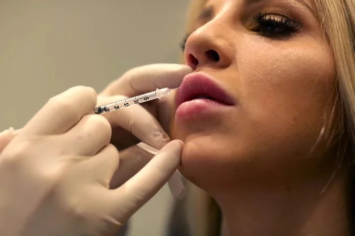 LIP INJECTIONS ARE DONE BY ALEXANDER RIVKIN, MD, IN HIS LOS ANGELES PRACTICE.