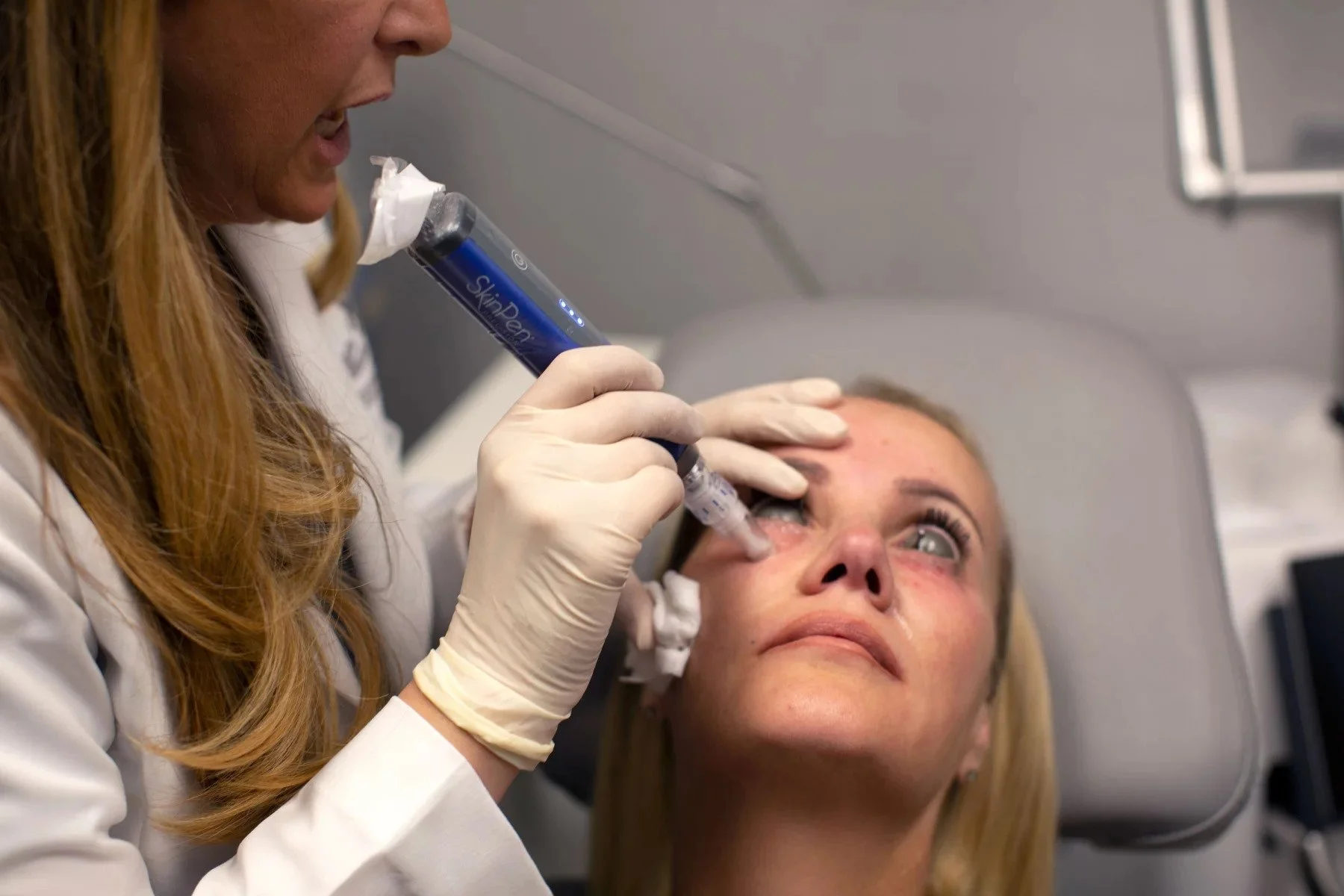 Dr. Grossman's patients wear eye shields during the procedure for protection.