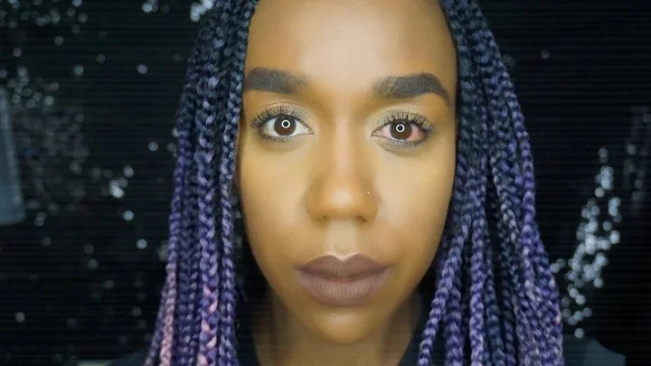 TANYA'S EYE INFECTION AFTER USING FAKE KYLIE COSMETICS SHADOWS. PHOTO: COURTESY OF SARAH TANYA.